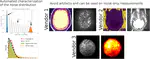 Automated characterization of noise distributions in diffusion MRI data